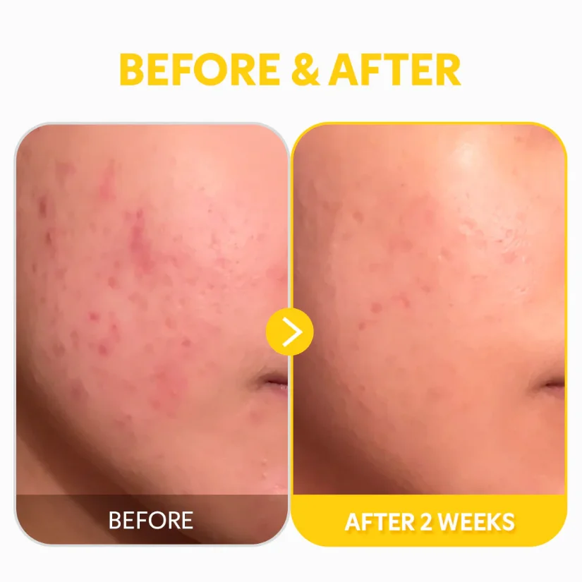 Picture of TIRTIR Pure Vitamin C24 Serum